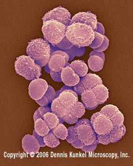 Scanning electron microscope picture of Deinococcus sp.
